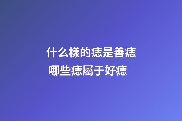 什么樣的痣是善痣 哪些痣屬于好痣